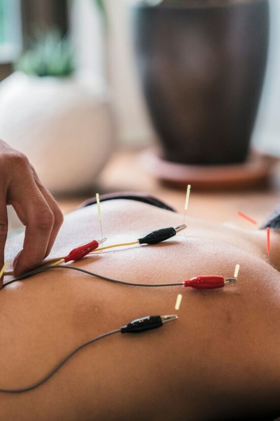 Condition-Based Acupuncture
